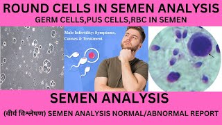 ROUND CELLS IN THE SEMEN, ITS SIGNIFICANCE.GERM CELLS,WBC ,RBC ,EPITHELIAL CELLS IN SEMEN ANALYSIS.