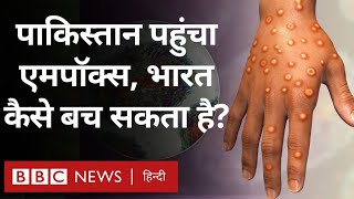 Mpox Virus: भारत के पड़ोसी देश Pakistan में एमपॉक्स की दस्तक, कैसे करें बचाव (BBC Hindi)