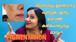 Pigmentation and treatment | Pigmentation(കരിമംഗല്യം) പൂർണമായും മാറും