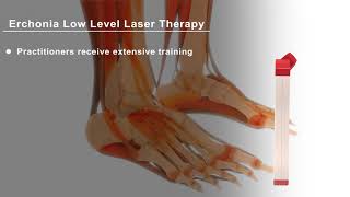 LLLT Patient Education: Low Level Laser Therapy for Foot Pain (Quick Version)