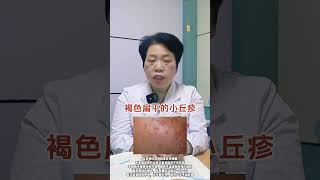 医学科普  科普一下  跟我涨知识 健康科普马主任 大数据推荐给有需要的人