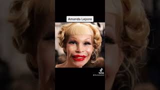 Craziest plastic surgery fails😳 #shorts