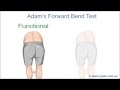 Adam's Forward Bend Test - A Chiropractic Online CE™ Production