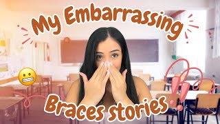 My Embarrassing Braces stories 😬 || #braces #embarrassingstories #bracesupdate