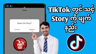 TikTok တွင် သင့် Story ကို ဖျက်နည်း (New Update 2024) android နှင့် iPhone ရှိ tik tok ဇာတ်လမ်းကို