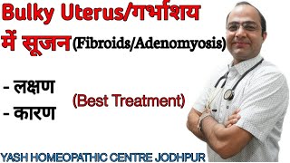 Bulky Uterus | Enlarged Uterus | Fibroid Adenomyosis | Treatment without surgery