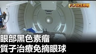 眼部黑色素瘤 質子治療免摘眼球 |【用心顧健康】| 2023021109 @gtvnews27