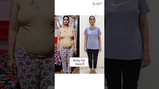 17 Kgs After Delivering Weight Loss with MyHealthBuddy