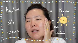 รูทีนแก้ rosacea | Current Morning Routine v2