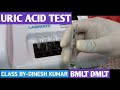 Uric Acid Test Practical Video | Uric Acid Test Principle Procedure by Semiautomatic Analyser