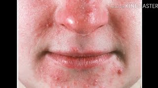 باقى سلسلة العنايه بالبشره 🙈😍#skincare