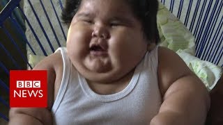 Why is this baby so overweight? - BBC News