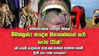 මිනිසුන්ට හැදෙන හිතා ගන්නවත් බැරි රෝග | Rare Syndrome | VK's View