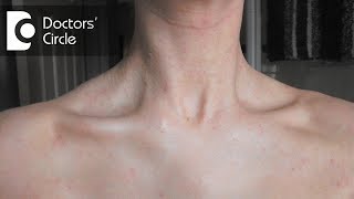 What causes a sudden red rash around the neck in women? - Dr. Aruna Prasad