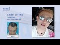 頭髮稀疏加密植髮哪家效果好？大概需要多少錢！yonghe hair transplant