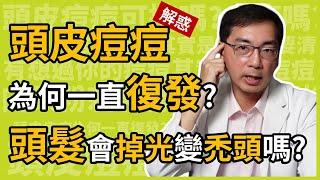 頭皮痘痘為何一直復發？頭髮會掉光光變禿頭嗎？皮膚科林政賢醫師教你十招改善頭皮毛囊炎！