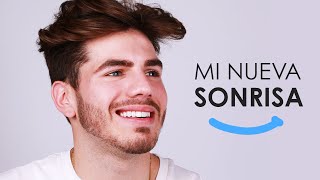 Franco Brizzith cambia su sonrisa en tan solo ¡2 CITAS!