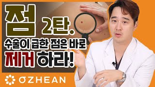 내 몸에 있는 '점' ! 제거해야 하는 모반은 따로 있다고?! [성형 알려주는 남자 이용석]