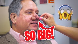 The BIGGEST Removals ever seen by Dr. Pimple Popper! (PART 3)
