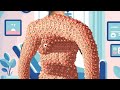 ASMR trypophobia Removal sleep big treatment man back | ASMR animation treatments @filmiASMR