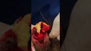 CYST SHOWERS | PT 2