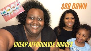 CHEAP \u0026 AFFORDABLE BRACES | $99 DOWN