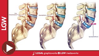 Legal Graphicworks Medical Illustrations