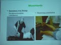 Ideal Examination of Hip Dr  Saraf - OrthoTV