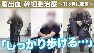 「足に力が入る！」幹細胞治療から11ヶ月間の密着【脳出血 50代男性 再生医療】