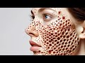 ASMR ANIMATION | BACK IN TREATMENT | REMOVE TRYPOPHOBIA  2D ANIMATION | RELAXING