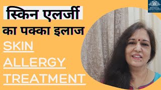 स्किन एलर्जी का पक्का इलाज Skin problems - Allergy/ Eczema/Urticaria/Hives/Acne/Pimples #shorts