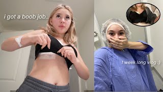 I got a BREAST AUGMENTATION surgery | 1 week recovery vlog + journey