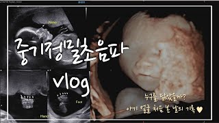 [임산부 브이로그] 임신 20주 | 중기정밀초음파 | 입체초음파 | 아기 얼굴 처음 본 날👶🏻💕