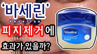 바세린 단돈 2천원으로 피지제거가 가능하다구? 실험을 해보자!