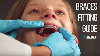 SISU Mouthguard | Braces Fitting Guide