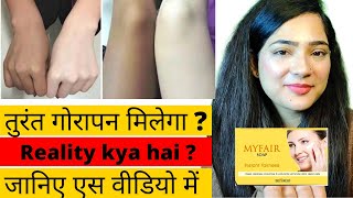 Skin whitening Soap | Myfair Soap Review | Best Fairness Soap | Skin Lightening Soap | Myfair