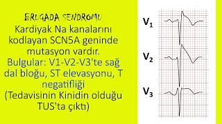 EKG YORUMLAMA (Kendini test et)