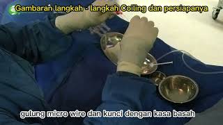 langkah - langkah Proses coiling