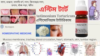 08. Antimonium Tartaricum l এন্টিম টার্ট l মেটেরিয়া মেডিকা l Materia Medical Learn Antim Tart easily