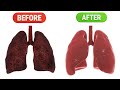Detoxify Your Lungs With These Everyday Habits | Easy Lung Cleanse Tips