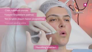 Mezolifting Uygulaması Antalya | DK Klinik