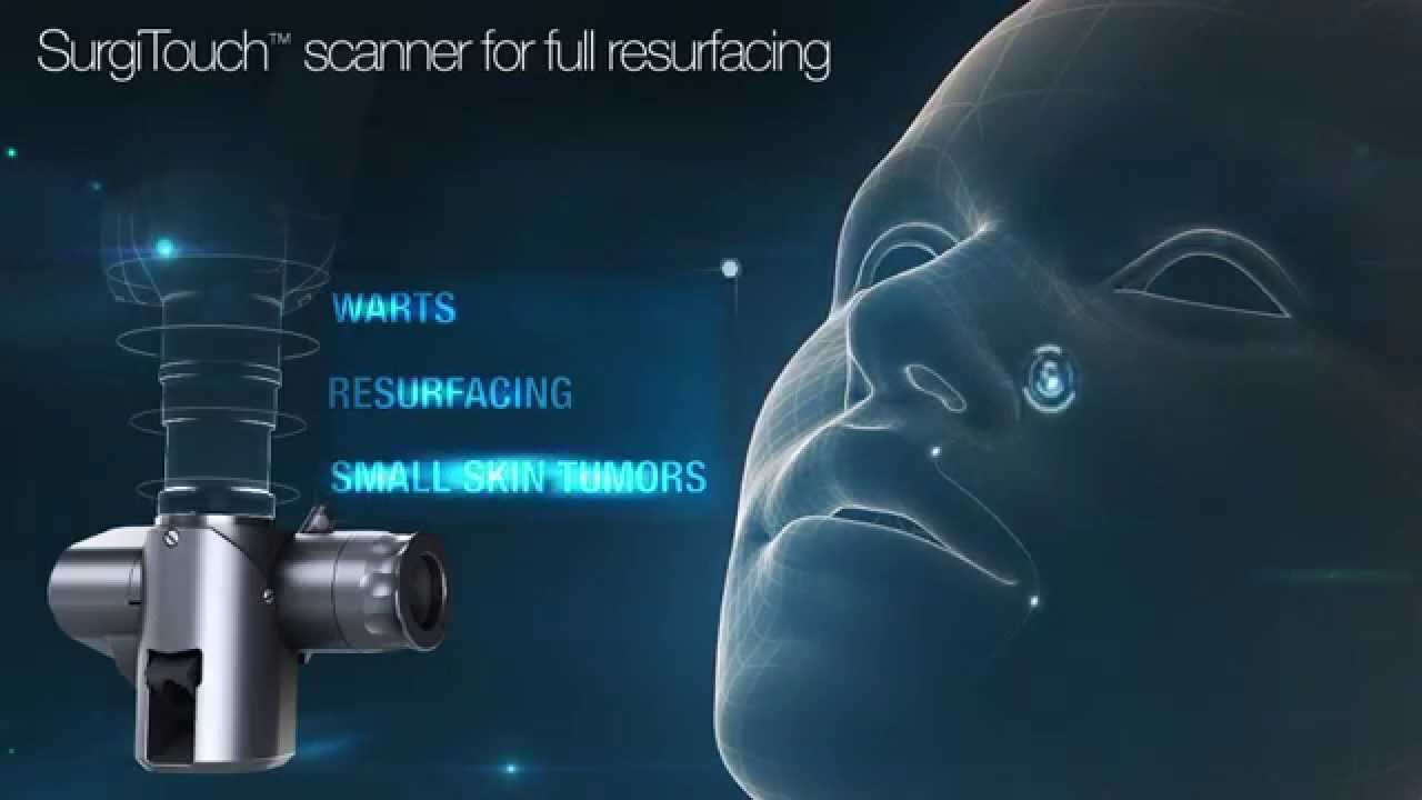 AcuPulse MultiMode SuperPulse CO2 Laser - YouTube