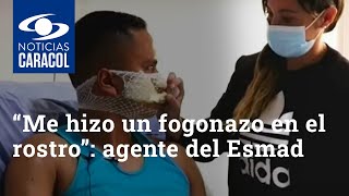 “Me hizo un fogonazo en el rostro”: agente del Esmad atacado con bomba molotov en Bogotá