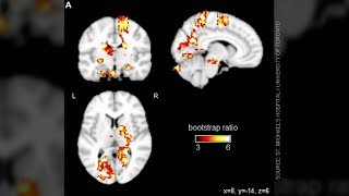 How non-contact and contact sports affect brain function