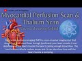 Myocardial Perfusion Scan & Thallium Scan #myocardialinfarction #heartattack