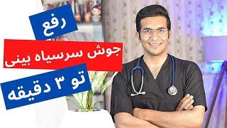 Treatment of blackheads | درمان جوش های سرسیاه بینی تو ۳ دقیقه