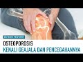 Apa Benar Osteoporosis Karena Kekurangan Kalsium? | Deteksi Penyakit