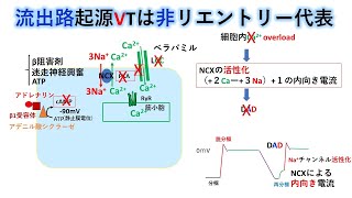 心電図：暗記からの卒業 97話 心室頻拍２