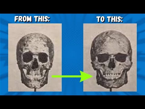 How can I improve my skull shape?