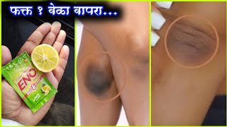 1 वेळ हा उपाय करा;dark elbow,dark neck शरीराच्या इतर त्वचेसारखे दिसतील। काळे घोटे,काळे ढोपर गुढगे